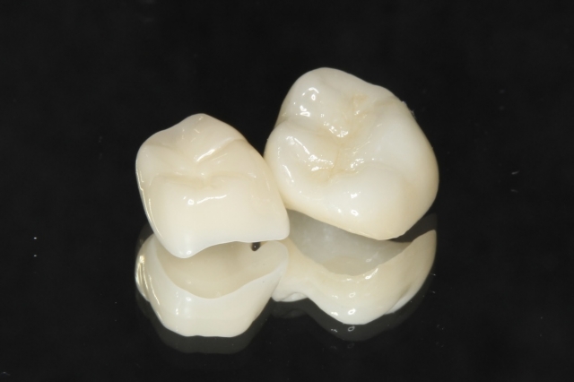 当院の審美治療の特徴